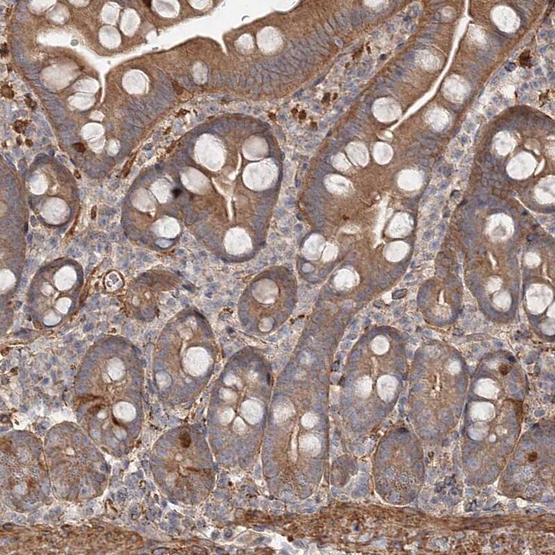 DHRS9 Antibody - BSA Free Immunohistochemistry-Paraffin: DHRS9 Antibody - BSA Free [NBP1-89379]