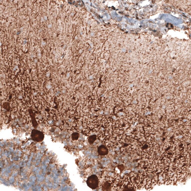 STAU2 Antibody - BSA Free Immunohistochemistry-Paraffin: STAU2 Antibody - BSA Free [NBP1-89380]