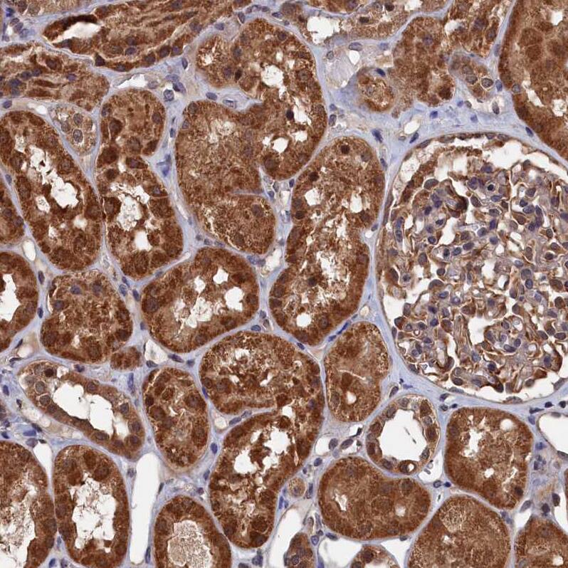 PDE12 Antibody - BSA Free Immunohistochemistry-Paraffin: PDE12 Antibody - BSA Free [NBP1-89381]