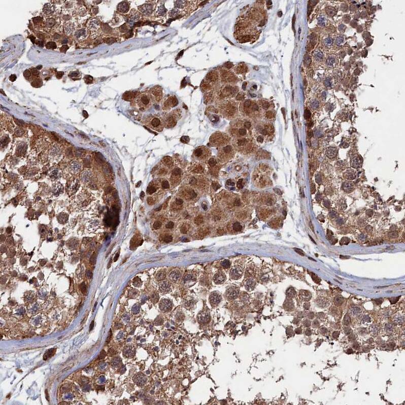 PDE12 Antibody - BSA Free Immunohistochemistry-Paraffin: PDE12 Antibody - BSA Free [NBP1-89381]