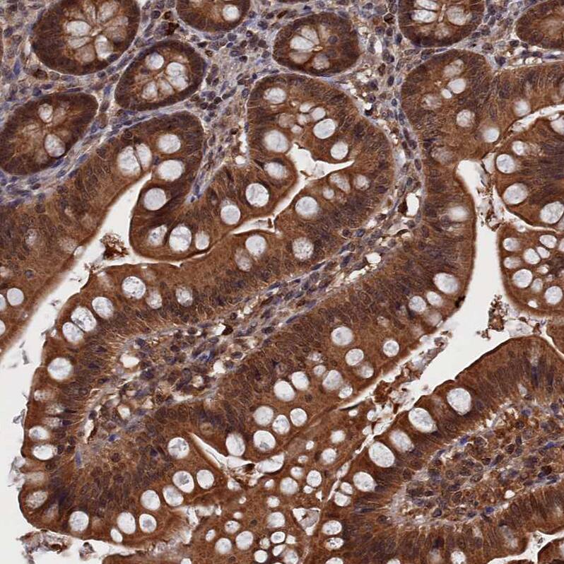 PDE12 Antibody - BSA Free Immunohistochemistry-Paraffin: PDE12 Antibody - BSA Free [NBP1-89381]