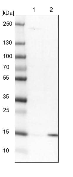 NDUFAF3 Antibody - BSA Free Western Blot: NDUFAF3 Antibody - BSA Free [NBP1-89382]