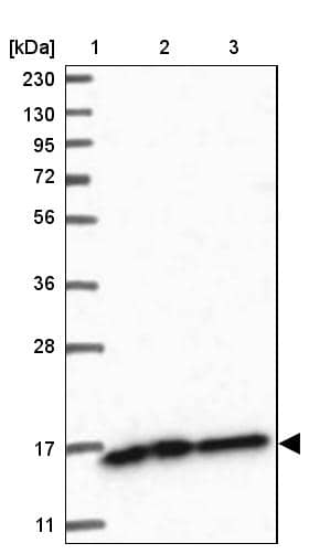NDUFAF3 Antibody - BSA Free Western Blot: NDUFAF3 Antibody - BSA Free [NBP1-89382]