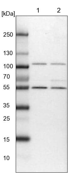 HPCL Antibody - BSA Free Western Blot: HPCL Antibody - BSA Free [NBP1-89384]