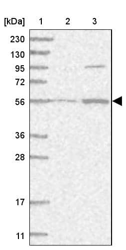 HPCL Antibody - BSA Free Western Blot: HPCL Antibody - BSA Free [NBP1-89384]