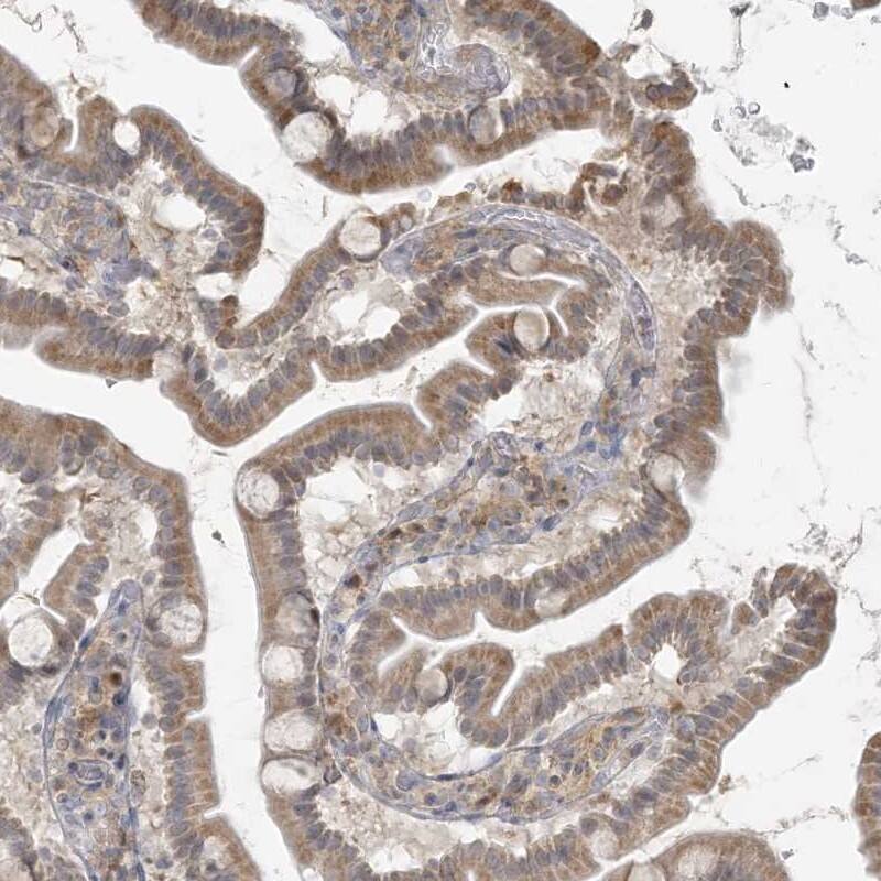 HPCL Antibody - BSA Free Immunohistochemistry-Paraffin: HPCL Antibody - BSA Free [NBP1-89384]