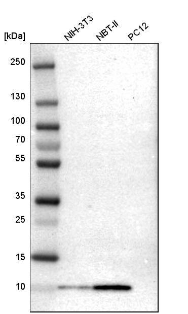 S100A6 Antibody - BSA Free Western Blot: S100A6 Antibody - BSA Free [NBP1-89388]