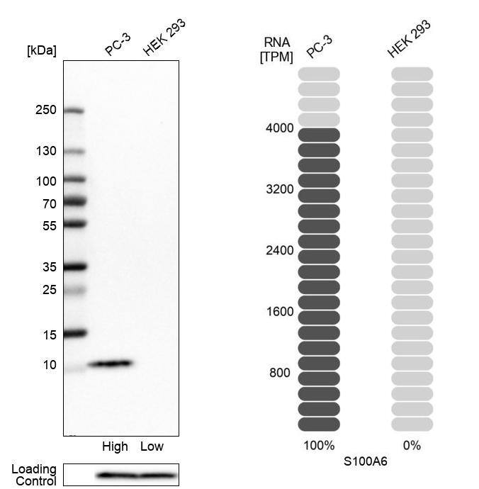 S100A6 Antibody - BSA Free Western Blot: S100A6 Antibody - BSA Free [NBP1-89388]