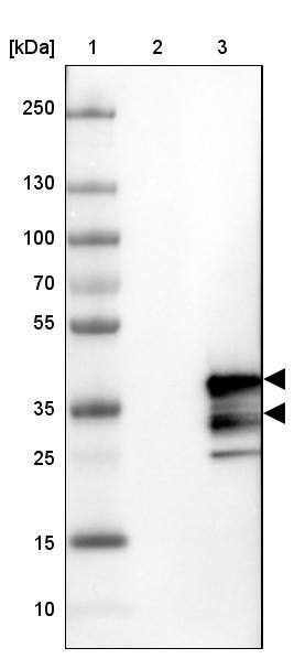 VPS24 Antibody - BSA Free Western Blot: VPS24 Antibody - BSA Free [NBP1-89391]