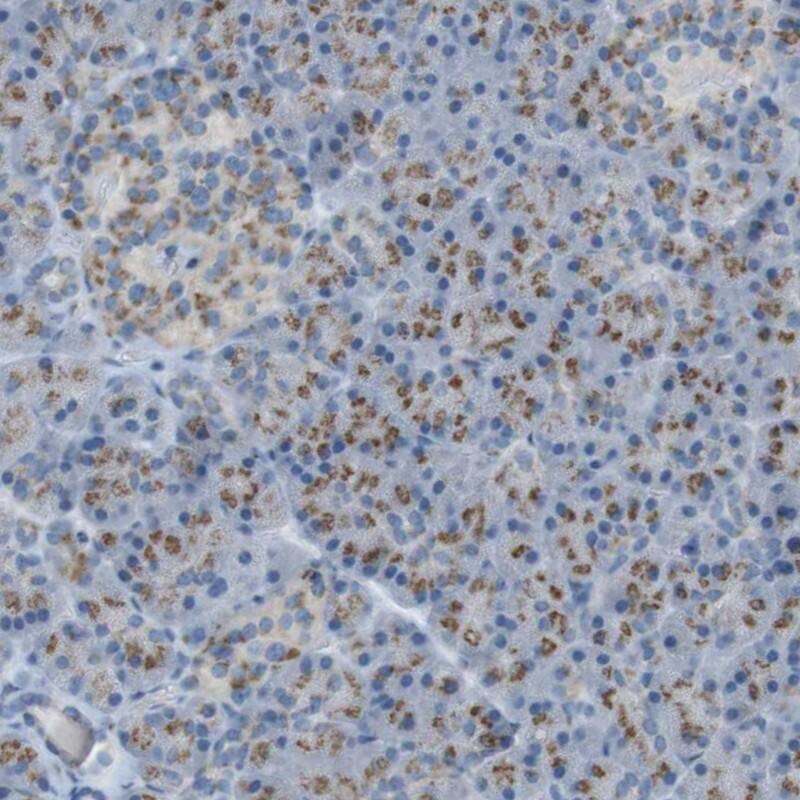 TXNDC15 Antibody - BSA Free Immunohistochemistry-Paraffin: TXNDC15 Antibody - BSA Free [NBP1-89394]
