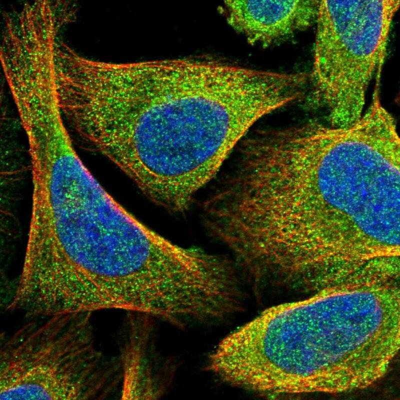 LMOD1 Antibody - BSA Free Immunocytochemistry/ Immunofluorescence: LMOD1 Antibody [NBP1-89396]