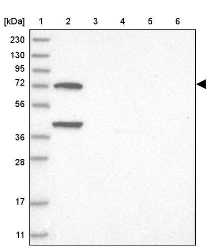 LMOD1 Antibody - BSA Free Western Blot: LMOD1 Antibody - BSA Free [NBP1-89396]