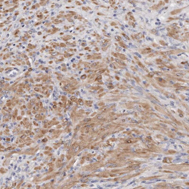 LMOD1 Antibody - BSA Free Immunohistochemistry-Paraffin: LMOD1 Antibody - BSA Free [NBP1-89396]