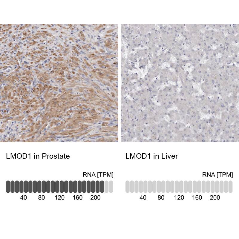 LMOD1 Antibody - BSA Free Immunohistochemistry-Paraffin: LMOD1 Antibody - BSA Free [NBP1-89396]
