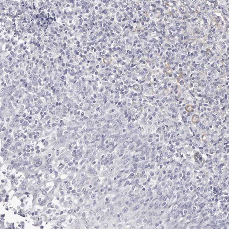 LMOD1 Antibody Immunohistochemistry-Paraffin: LMOD1 Antibody [NBP1-89397]
