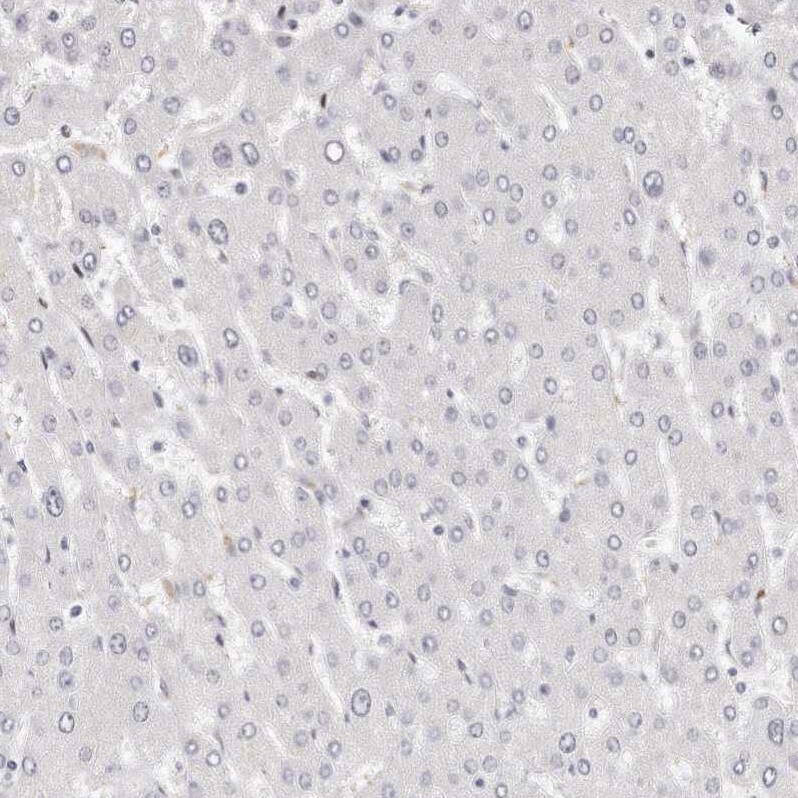 LMOD1 Antibody Immunohistochemistry-Paraffin: LMOD1 Antibody [NBP1-89397]
