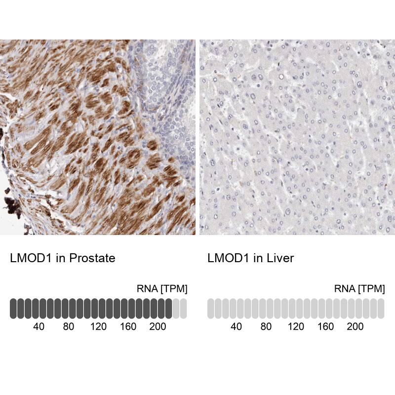 LMOD1 Antibody Immunohistochemistry-Paraffin: LMOD1 Antibody [NBP1-89397]