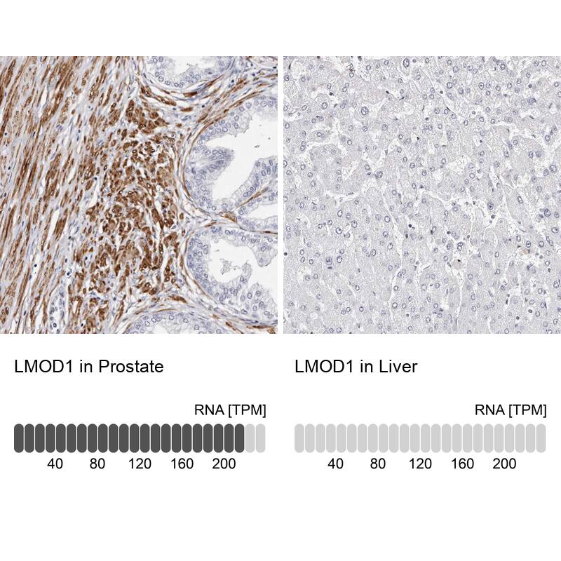 LMOD1 Antibody - BSA Free Immunohistochemistry-Paraffin: LMOD1 Antibody - BSA Free [NBP1-89398]