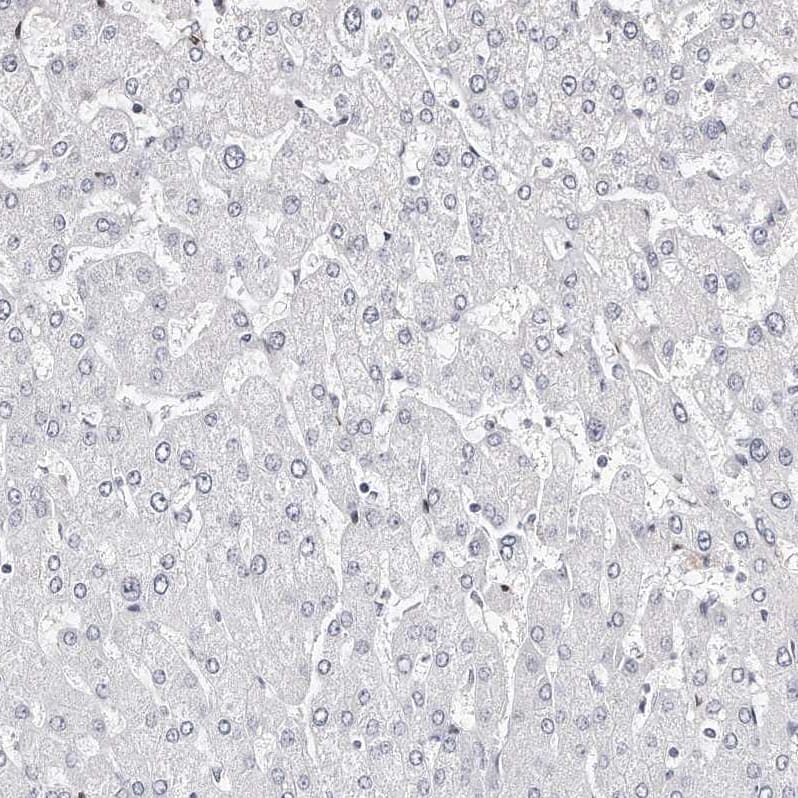 LMOD1 Antibody - BSA Free Immunohistochemistry-Paraffin: LMOD1 Antibody - BSA Free [NBP1-89398]