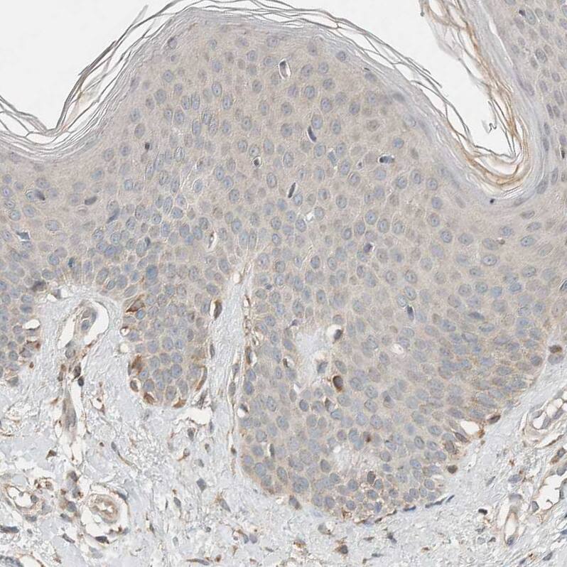 NBR1 Antibody - BSA Free Immunohistochemistry-Paraffin: NBR1 Antibody - BSA Free [NBP1-89400]
