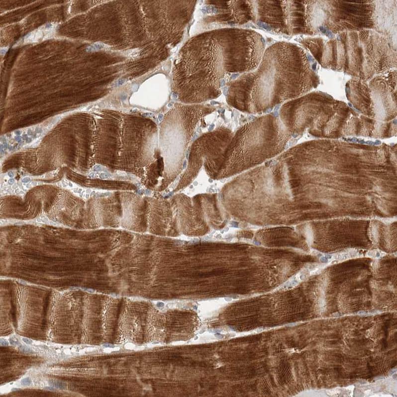 NBR1 Antibody - BSA Free Immunohistochemistry-Paraffin: NBR1 Antibody - BSA Free [NBP1-89400]