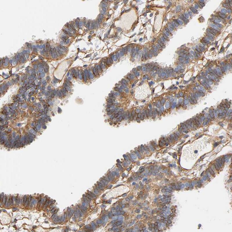IFITM3/Fragilis Antibody - BSA Free Immunohistochemistry-Paraffin: IFITM3/Fragilis Antibody - BSA Free [NBP1-89401]