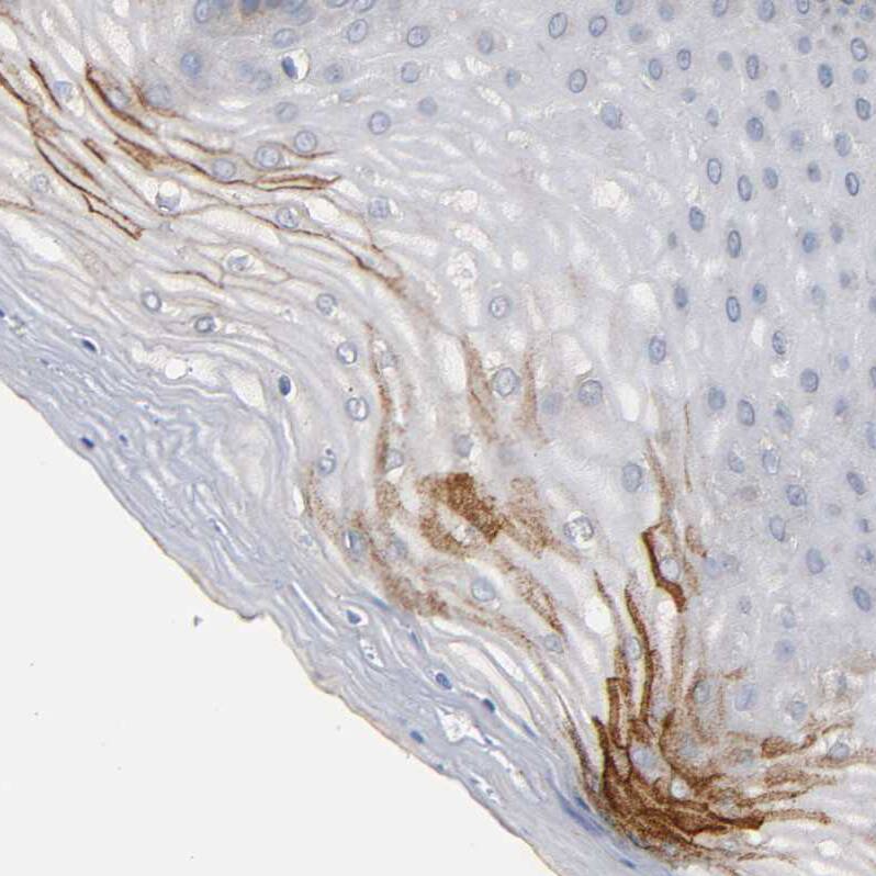 IFITM3/Fragilis Antibody - BSA Free Immunohistochemistry-Paraffin: IFITM3/Fragilis Antibody - BSA Free [NBP1-89401]