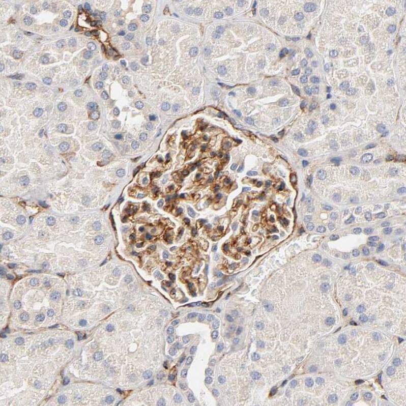 IFITM3/Fragilis Antibody - BSA Free Immunohistochemistry-Paraffin: IFITM3/Fragilis Antibody - BSA Free [NBP1-89401]