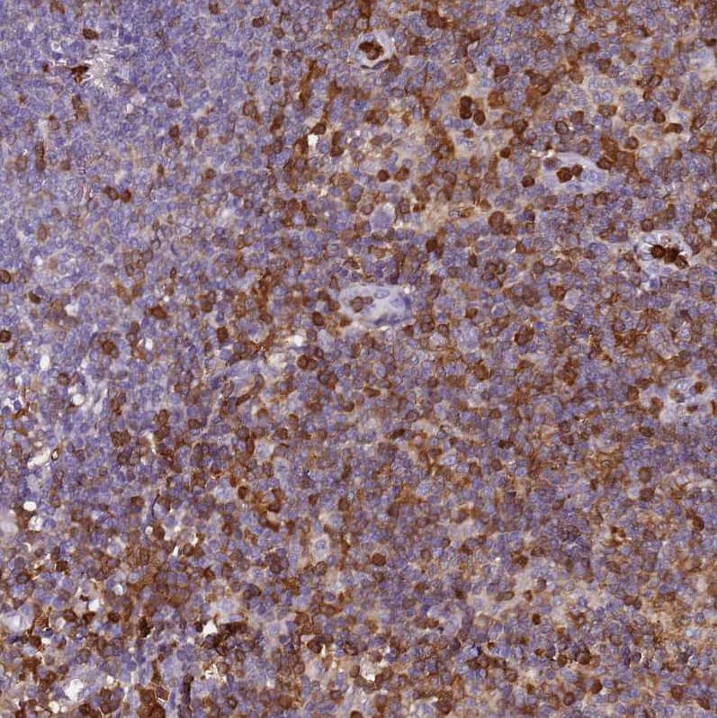 S100A4 Antibody - BSA Free Immunohistochemistry-Paraffin: S100A4 Antibody - BSA Free [NBP1-89402]