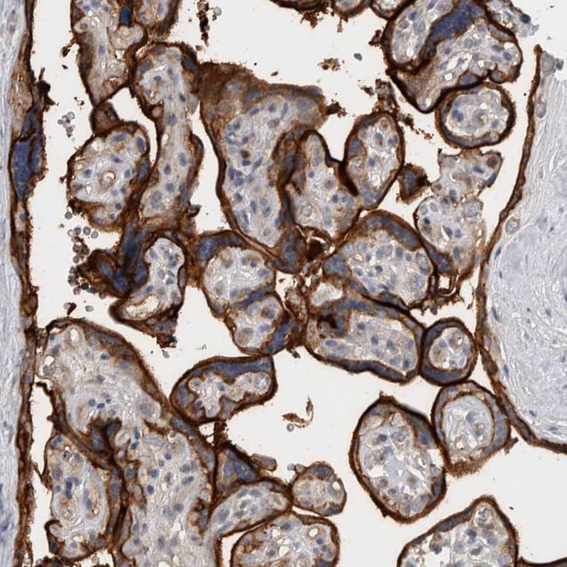 CD59 Antibody - BSA Free Immunohistochemistry-Paraffin: CD59 Antibody - BSA Free [NBP1-89405]