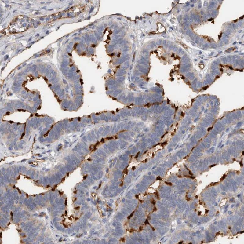 CD59 Antibody - BSA Free Immunohistochemistry-Paraffin: CD59 Antibody - BSA Free [NBP1-89405]
