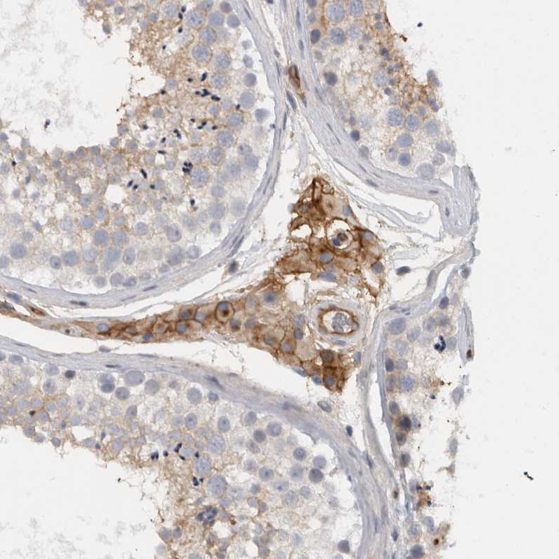 CD59 Antibody - BSA Free Immunohistochemistry-Paraffin: CD59 Antibody - BSA Free [NBP1-89405]