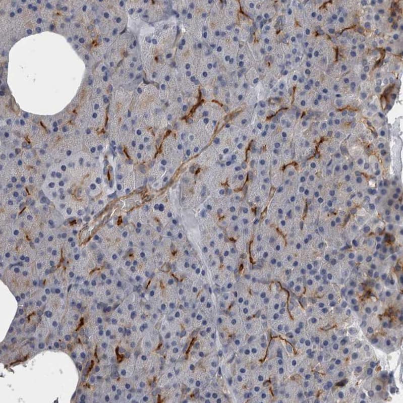 CD59 Antibody - BSA Free Immunohistochemistry-Paraffin: CD59 Antibody - BSA Free [NBP1-89405]