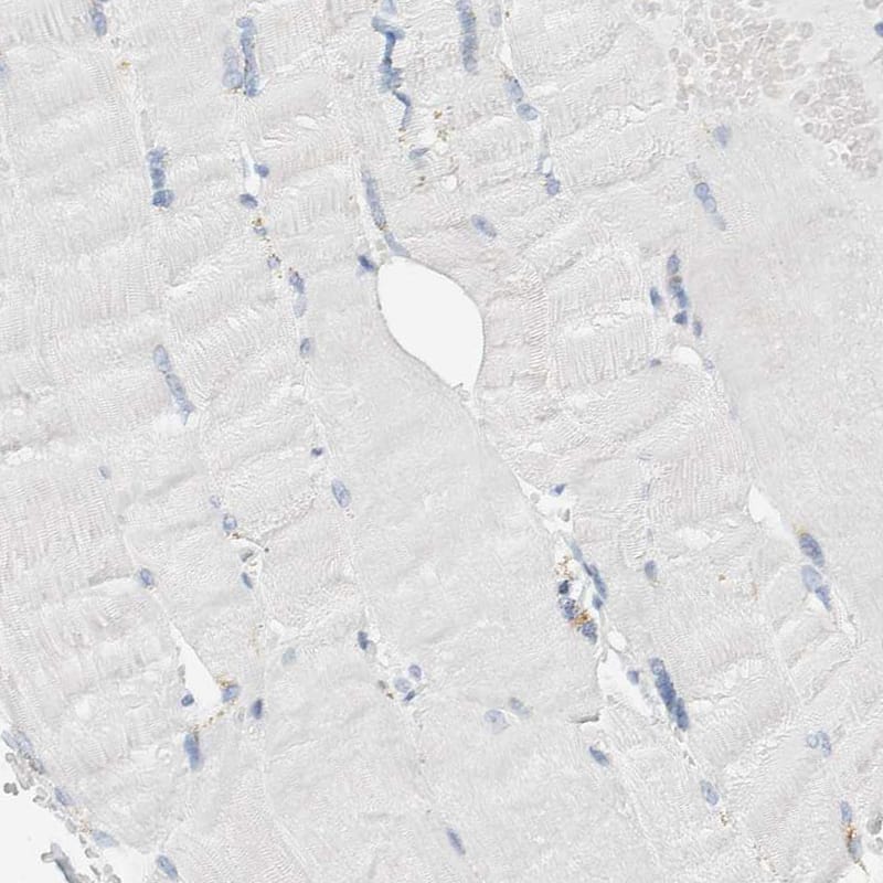 ALOX12B Antibody - BSA Free Immunohistochemistry-Paraffin: ALOX12B Antibody [NBP1-89409]