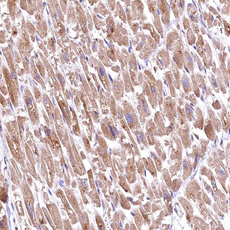 RASSF1 Antibody - BSA Free Immunohistochemistry-Paraffin: RASSF1 Antibody - BSA Free [NBP1-89411]