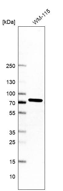 MAGED2 Antibody - BSA Free Western Blot: MAGED2 Antibody - BSA Free [NBP1-89412]