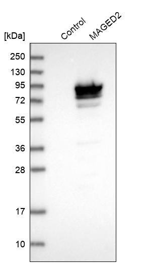MAGED2 Antibody - BSA Free Western Blot: MAGED2 Antibody - BSA Free [NBP1-89413]