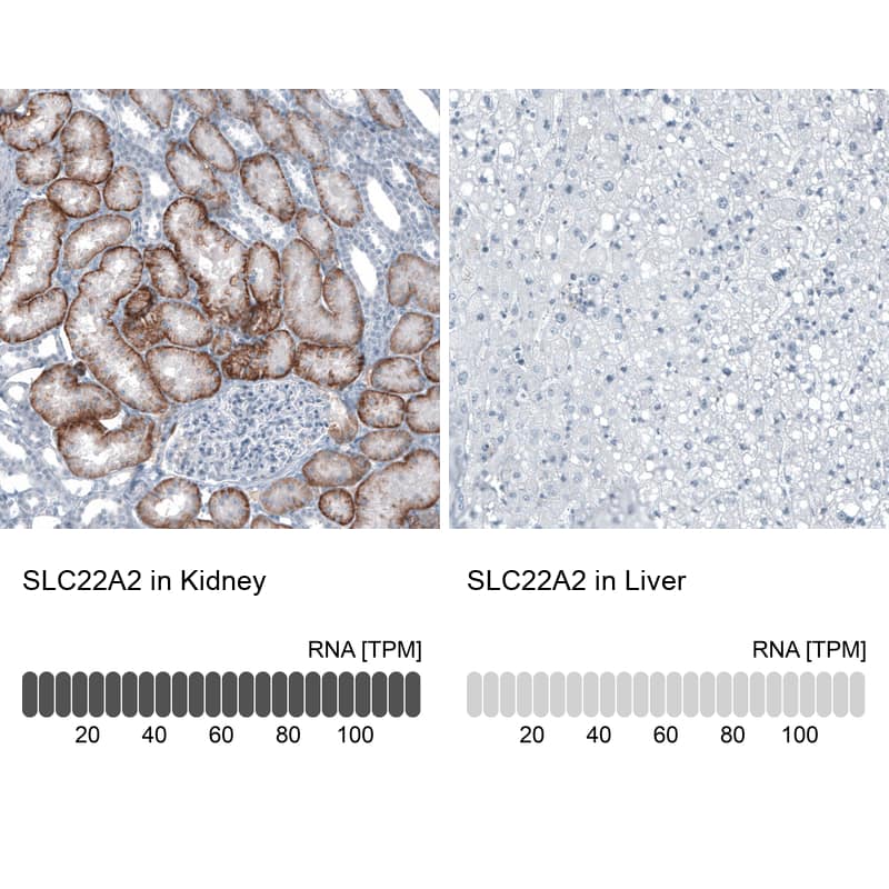 SLC22A2/OCT2 Antibody - BSA Free Immunohistochemistry-Paraffin: SLC22A2/OCT2 Antibody - BSA Free [NBP1-89417]