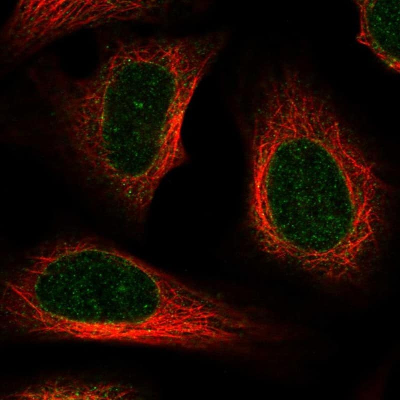 AAAS Antibody - BSA Free Immunocytochemistry/ Immunofluorescence: AAAS Antibody - BSA Free [NBP1-89424]