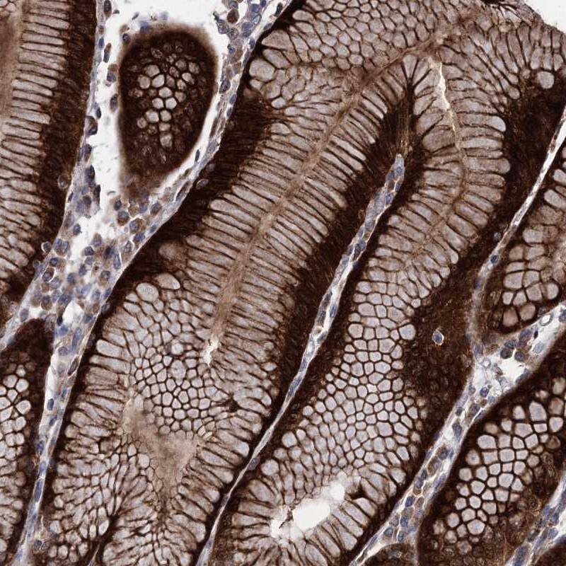 RASSF3 Antibody - BSA Free Immunohistochemistry-Paraffin: RASSF3 Antibody [NBP1-89425]