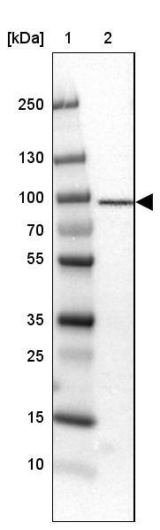 TARS Antibody - BSA Free Western Blot: TARS Antibody - BSA Free [NBP1-89427]