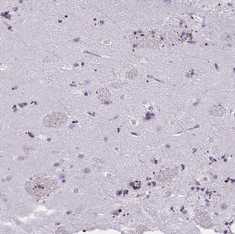 MOBP Antibody - BSA Free Immunohistochemistry-Paraffin: MOBP Antibody - BSA Free [NBP1-89430]