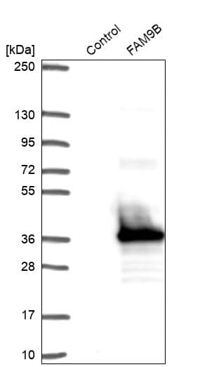 FAM9B Antibody - BSA Free Western Blot: FAM9B Antibody - BSA Free [NBP1-89431]