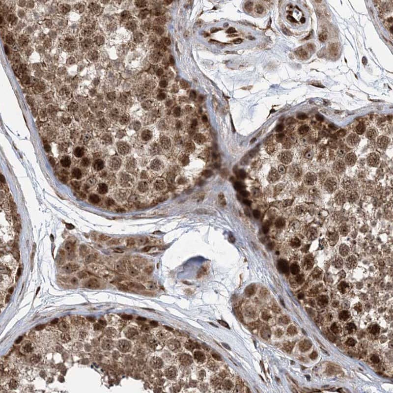 FAM9B Antibody - BSA Free Immunohistochemistry-Paraffin: FAM9B Antibody - BSA Free [NBP1-89431]