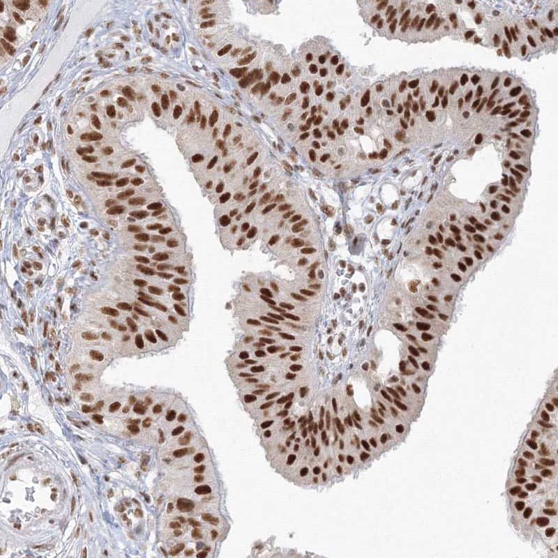 PPP4R2 Antibody - BSA Free Immunohistochemistry-Paraffin: PPP4R2 Antibody - BSA Free [NBP1-89432]