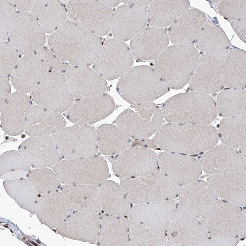 IRF2 Antibody - BSA Free Immunohistochemistry-Paraffin: IRF2 Antibody - BSA Free [NBP1-89433]
