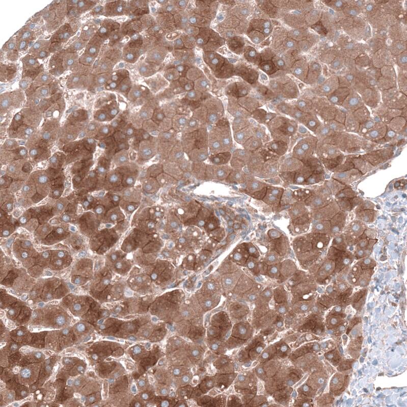 AGL Antibody - BSA Free Immunohistochemistry-Paraffin: AGL Antibody - BSA Free [NBP1-89440]
