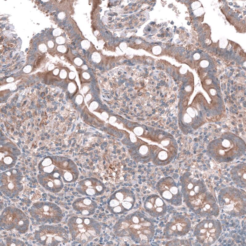 AGL Antibody - BSA Free Immunohistochemistry-Paraffin: AGL Antibody - BSA Free [NBP1-89440]