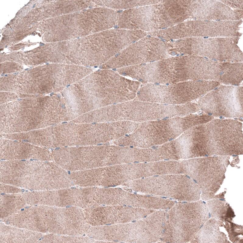 AGL Antibody - BSA Free Immunohistochemistry-Paraffin: AGL Antibody - BSA Free [NBP1-89440]