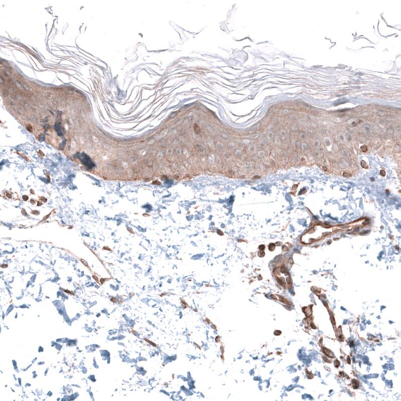 AGL Antibody - BSA Free Immunohistochemistry-Paraffin: AGL Antibody - BSA Free [NBP1-89440]